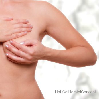 Preventief onderzoek borstkanker