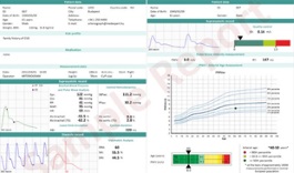 De Arteriograph meet de vaatwandstijfheid, centrale bloeddruk en stress van de kleine bloedvaten